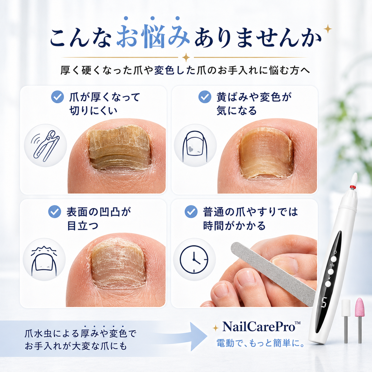 NailCarePro™ - 厚く硬くなった爪をもっと手軽になめらかに !